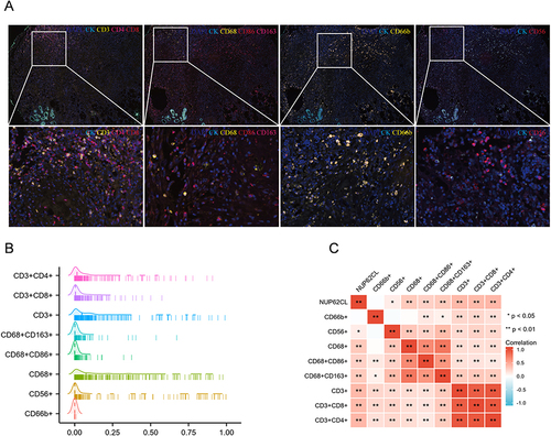 Figure 6 (A) Representative multiplex immunofluorescence staining images detecting different immune cell types in OSCC tissues. (B) The infiltration levels of TIICs in OSCC. (C) NUP62CL expression was related to TIICs abundance. *P<0.05, **P<0.01.