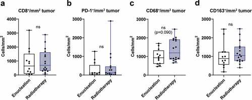 Figure 5. Tumor infiltration of immune cells and treatment of primary tumor. Uveal melanoma patients were dichotomized into two groups, enucleation or radiotherapy, based on treatment of their primary uveal melanoma. The number of tumor infiltrating (a) CD8+ cells, (b) PD-1+ cells, (c) CD68+ and (d) CD163+ cells in liver metastases obtained prior to IHP were thereafter analyzed in each group (n = 28, Mann-Whitney test)