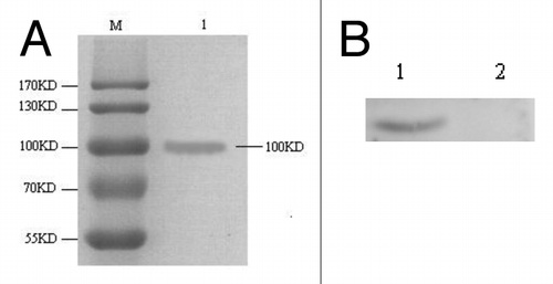 Figure 1. The identify of the EV71-P1 protein. (A) The SDS-PAGE analysis of P1 protein. The concentration of separatin gel was 10% for SDS-PAGE. M, market; 1, the purified P1 protein. (B) western blot analysis of P1 protein. The concentration of separating gel was 10% for western blot. 1, the purified P1 protein; 2, the pPIC9k-GS115 supernatant.
