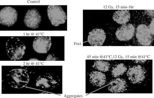 Figure 14. Hyperthermia appears to induce the formation of aggregates containing MRE11, associated with the nuclear matrix. Reprinted from Ref. 49.