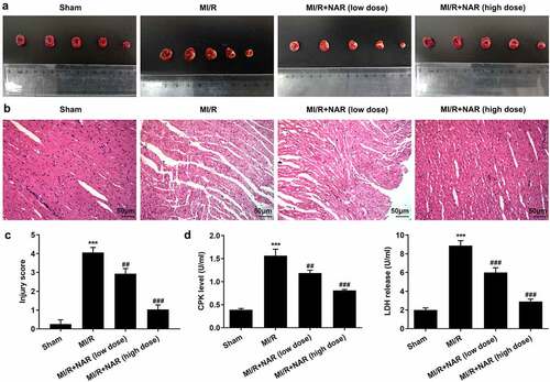 Figure 2. NAR alleviated MI/R induced pathologic damage. A. TTC Staining detected the area of myocardial infarction. B. H&E staining was used to detect myocardial injury. Magnification×200. C. CPK and LDH levels were detected with the kits. ***p < 0.01 vs Sham; ##p < 0.01, ### p < 0.001 vs MI/R