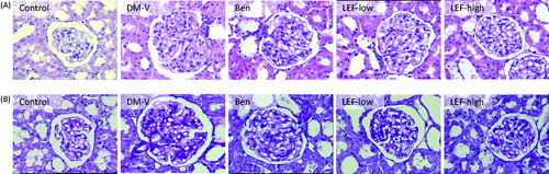 Figure 3. Representative hematoxylin & eosin staining (A) and PAS staining (B) in the kidney of rats from various groups. DM, diabetes mellitus group; V, vehicle; Ben, benazepril; LEF, leflunomide; Magnification = 400×.