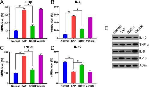 Figure 4. Transcription and translation of inflammatory (IL-1β, IL-6, and TNF-α) and anti-inflammatory (IL-10) cytokines in pancreatic tissue. (A-D) Q-PCR is conducted to examine the expression of IL-1β, IL-6, TNF-α, and IL-10 in pancreatic specimens after 12 h. GAPDH serves as an internal control. (E) WB is employed to determine protein concentration of these cytokines. Result is presented in the form of mean ± SD (n = 15 per group). Differences among various groups are assessed using ANOVA. *P < 0.05.