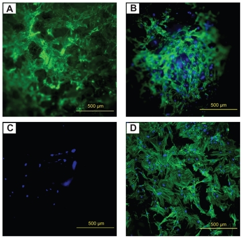 Figure 2 Fluorescence images of human MSC adhesion on (A) HA-Ps-PLGA, (B) HA-PLGA, (C) PLGA, and (D) glass after 6 days of culture.Notes: Scale bar = 500 μm. Green stains, F-actin cytoskeleton. Blue stains, nucleus of human MSC.Abbreviations: HA, hydroxyapatite; PLGA, polylactide-co-glycolide; P, peptide; MSC, mesenchymal stem cells; Ps, peptide loaded by aminosilane chemistry.