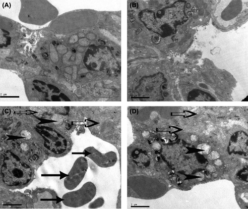 Figure 4. Representative transmission electron microscopy images of lung tissues were shown in four groups at 12 h (original magnification of × 10000). The control group (A) and BML-111control group (B) showed complete mitochondrial outer membrane and distinct mitochondrial cristae in type Ⅱ alveolar epithelial cell. The APALI group (C) showed mitochondrial swelling and outer membrane blurred (open arrows), mitochondrial cristae disappeared, vacuolar degeneration of lamellar body (arrowheads), red blood cells (closed arrows) and the active substance were leaked into the alveolar space. The BML-111 pretreatment group (D) showed slight swelling of mitochondria, incomplete mitochondrial cristae, and little vacuolar degeneration in lamellar body.