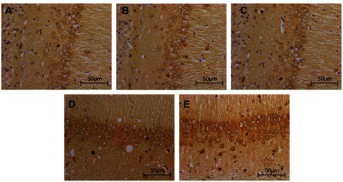 Figure 3 Effects of TCST on the inflammatory responses of hippocampi in TBI rats. Immunohistochemical staining of IL-6 in the hippocampi of TBI rats after TCST (400×s). A-E: (A–C) The visual fields at time T0 in Sham group, TBI group and TBI+TCST group under an optical microscope. Minor hippocampal IL-6 expression was observed at T0 in the three groups. (D) The visual fields at all time points except for T5-7 in TBI+TCST group under an optical microscope. The expression of IL-6 was increased in TBI+TCST group compared to that in the other groups. (E) The visual fields at all time points except for T7 in TBI group under an optical microscope. The expression of IL-6 was increased more significantly in TBI group than in the other two groups. Six rats per group.