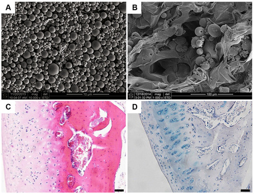 Figure 3 Collagen/silk fibroin composite scaffold incorporated with TGF-β1 loaded PLGA microspheres for cartilage repair. (A) SEM image of TGF-β1 loaded PLGA microsphere. (B) SEM image of composite scaffold incorporated with PLGA microspheres. (C) H&E staining showed a well-developed regenerated hyaline articular cartilage in the group of composited scaffolds with TGF-β1 loaded PLGA microspheres. (D) By Alcian blue staining, an abundance of cartilage matrices that were found in the group of composited scaffolds with TGF-β1 loaded PLGA microspheres. Scale bar: 50 µm.Notes: Reprinted from Wang J, Yang Q, Cheng N, et al. Collagen/silk fibroin composite scaffold incorporated with PLGA microsphere for cartilage repair. Mater Sci Eng C Mater Biol Appl. 2016;61:705–711. Copyright (2016), with permission from Elsevier.Citation102