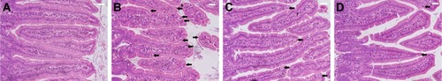 Figure 2 Histology of the jejunum showing the parasitic stages.Notes: (A) Non-infected jejunum. (B) Infected jejunum. (C) Jejunum treated with NaSe. (D) Jejunum treated with SeNPs. Different developmental stages (arrows) appearing inside the jejunal epithelium. Sections stained with H&E. Scale bar=100 μm. N=5.Abbreviations: NaSe, sodium selenite; SeNPs, selenium nanoparticles.