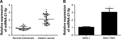 Figure 1 Upregulation of miR-21-5p expression in GC tissues and GC cell lines analyzed by qRT-PCR.