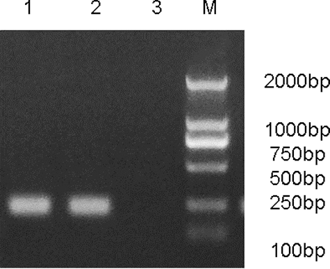 Figure 3. Production of recombinant adenovirus identified by PCR in 293 cells. Lane 1: pAd/PL-DEST vector; Lane 2: pAd-Cav3.3 shRNA; Lane 3: negative control.