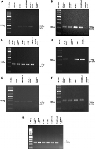 Figure 1. RT-PCR results of PcG, BID, and BIM genes in K562 and K562/IMA-3 cell lines. (A) RT-PCR results of the BIM gene: (1) M:50 bp, (2) No DNA, (3) K562 cells, (4) K562/IMA-3 cells, (5) positive control, (6) negative control. (B) RT-PCR results of the EED2 gene: (1) M:50 bp, (2–3) positive control, (4) K-562 cells, (5) K-562/IMA-3 cells, (6) negative control. (C) RT-PCR results of the BID gene: (1) M:50 bp, (2–4) positive control, (5) K562 cells, (6) K562/IMA-3 cells, (7) negative control. (D) RT-PCR results of the SUZ12 gene: (1) M:50 bp, (2) positive control, (3) negative control, (4) K562 cells, (5) K562/IMA-3 cells, (E) RT-PCR results of SIRT1 gene: (1) M:50 bp, (2) K562 cells, (3) K562/IMA-3 cells, (4) positive control, (5) negative control. (F) RT-PCR results of the EZH2 gene: (1) M:50 bp, (2–3) positive control, (4) K562 cells, (5) K562/IMA-3 cells, (6) negative control. (G) RT-PCR results of GAPDH gene: (1) M:50 bp, (2–3) positive control, (4–5) K-562 cells, (6–7) K562/IMA-3 cells, (8) negative control.