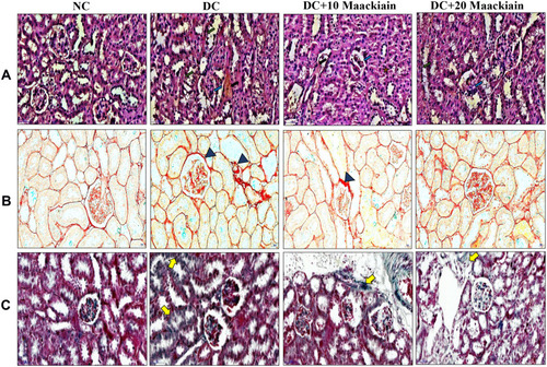 Figure4 The effects of maackiain histopathology in HFD & low STZ induced diabetic rats. (A) Hematoxylin and Eosin (H&E) staining; (B) Picro Sirius Red (PSR) staining; (C) Masson’s Trichrome (MT) staining; H& E(Black color arrow shows necrosis, Green color arrow shows thickened glomerular basement membrane, blue color arrow shows increased glomerular space). PSR and MT (Blue color triangle shows collagen deposition and yellow color arrow also shows collagen deposition). Magnification = x40; Scale bar = 100µm.
