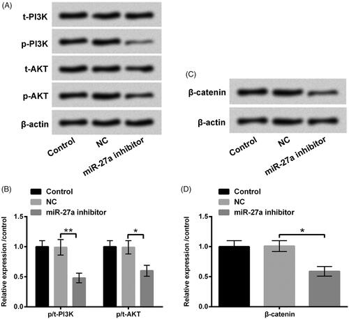 Figure 6. Repressed miR-27a blocked PI3K/AKT and Wnt/β-catenin pathways in HTM cells. HTM cells were transfected with miR-27a inhibitor and NC, (A and B) p/t-PI3K and p/t-AKT, and (C and D) β-catenin protein levels were appraised using western blot. MiR-27a: microRNA-27a; PI3K: phosphatidylinositol 3-kinase; AKT: protein kinase B; *p < .05; **p < .01.