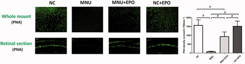 Figure 4. The typical PNA staining was detected in the retinal sections of normal control group. Conversely, no PNA staining was found in the retina sections of the MNU group. The PNA staining could also be detected at the outer segments of EPO treated group. The staining results from the whole mounts agreed well with those from the retinal sections. The PNA staining density of the MNU group was smaller than the normal controls. On the other hand, the PNA staining density of the EPO treated group was significantly larger than the MNU group (#p < .01, for differences compared between animal groups; all the values were presented as mean ± SD).