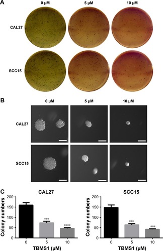 Figure 2 TBMS1 inhibited colony formation ability of OSCC cells in vitro.
