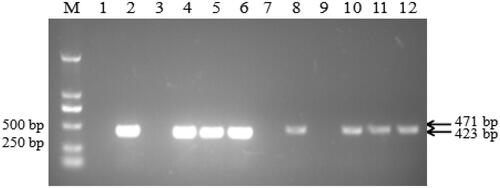 Figure 2. PCR detection of rolB and IRT1 genes of transgenic B. campestris L.hairy root. M: DL2000 DNA Marker; Lane 1-6: amplified rolB gene fragments; lane 7-12: amplified IRT1 gene ftragments. 1: blank control; 2: Ri plasmid; 3: Negative control; 4-6: transgenic IRT1 hairy roots; 7: blank control; 8: IRT1-pRI101 plasmid; 9: Negative control; 10-12: transgenic IRT1 hairy roots.