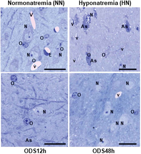 Figure 3. Comparison pane between 1 µm semi-thin sections stained by toluidine blue of representativeNormonatremic, Hyponatremic, ODS 12h, and ODS 48 h murine thalamus where some examples ofastrocytes (A), neurons (N), oligodendrocytes (O) and blood vessels (V) lined by endothelium (E) aremarked. Some empty spaces, marked by stars, are examples of some of the parenchymal cavities resultingfrom myelinolysis. Scales equals to 20 µm for all micrographs