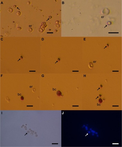 Figure 3 Small putative stem cells (arrows) from ovarian surface epithelium in a patient with premature ovarian failure and no naturally present follicles and oocytes.