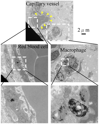 Figure 7. TEM examination of a tumor after injection of 30-nm Au-PEG nanoparticles. The nanoparticles were observed in the capillary vessel wall and were ingested by phagocytes around the capillary. Yellow arrowheads show the red blood cells in the capillary vessels of the tumor.