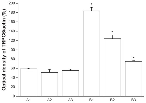 Figure 3 Representative Western blotting of three determinations (mean ± standard error of the mean, bottom).