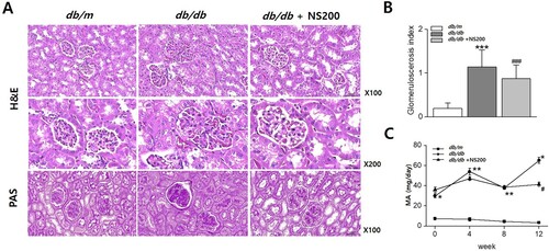 Figure 2. The kidneys of diabetic db/db mice exhibit more severe glomerulosclerosis than in non-diabetic db/m mice (A, B). NS200 improves glomerulosclerosis in diabetic db/db mice (A, B). Urinary albumin excretion is higher in diabetic db/db mice than in non-diabetic db/m. NS200 decreases urinary albumin excretion after 12 weeks of treatment (C). H&E, Hematoxylin and eosin; PAS, Periodic acid- Schiff. Values are expressed as mean ± SEM. *p < 0.05 db/m mice with vehicle vs db/db mice with vehicle, **p < 0.01 db/m mice with vehicle vs db/db mice with vehicle,***p < 0.001 db/m mice with vehicle vs db/db mice with vehicle, #p < 0.05 db/db mice with vehicle vs db/db mice with NS200, ### p < 0.001 db/db mice with vehicle vs db/db mice with NS200