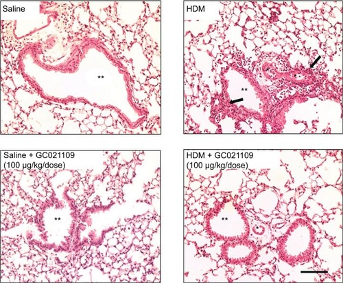 Figure 2 GC021109 prevents HDM-induced peribronchiolar and perivascular inflammatory cell infiltration.