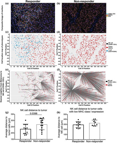 Figure 3. Spatial distribution of NK cells with melanoma cells.Representative images of an area from a responding patient (a) and a non-responding patient (b) to PD-1 treatment for spatial distribution analysis. (c) and (d) Cell location maps of the T cells, NK cells and tumor cells in representative responding and non-responding patients. (e) and (f) Visual depiction of the nearest neighbor calculation between NK cells and tumor cells. (g) NK cell distance to tumor cells. (h) NK cell distance to tumor cells with low MHC class I expression.