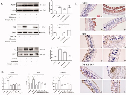 Figure 6. Effects of HQD on NOD2-dependent pathway. (a) The proteins of MyD88, RIP2, and P65 in colitis mice by western blot. The expression was normalized to that of β-actin and proliferating cell nuclear antigen (PCNA). (b) Impact of HQD on the mRNA expression of NOD2, RIP2, and NF-κB p65 in colon samples isolated from mice (n = 6 per group). The expression was normalized to that of Gapdh. (c) Impact of HQD on the expression of proteins in the NOD2 signalling pathway in DSS-induced colitis in mice, as determined by IHC (A, Control; B, model; C, sulfasalazine; D, HQD. Magnification × 200). Scale bar: 50 μm. Data are expressed as the means ± SD of three independent experiments. *p < 0.01, **p < 0.001 versus DSS-treated group; #p < 0.05, ##p < 0.01 model versus control.