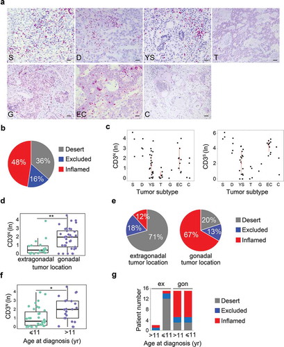 Figure 1. Density of tumor-infiltrating CD3+ T cells in meGCTs a, Representative IHC images for CD3+ T cell staining in primary meGCT samples. The density of T cells was recorded as the number of positive cells per unit of tissue surface area. Nuclei were counterstained with hematoxylin (blue). Original magnification, x20. Scale bar, 30 µm. b, Distribution of tumor-infiltrating CD3+ T cells in meGCTs. c, Density of CD3+ T cells in the nest and septa tumor regions of the various meGCT subtypes. d, Box plot of the CD3+ T-cell density in the nest region according to the tumor location. e, Distribution of tumor-infiltrating CD3+ T cells in meGCTs according to tumor location. f, Box plot of the CD3+ T-cell density in the nest region according to age at diagnosis. g, Distribution of tumor-infiltrating CD3+ T cells in meGCT patients according to tumor location and age at diagnosis. In D and F, the boxes show the 25th to 75th percentile, the horizontal line inside the box represents the median, the whiskers extend to the most extreme data point, which is no more than 1.5 times the interquartile range from the box, and the circles are individual samples. S, seminoma; D, dysgerminoma; YS, yolk sac tumors; T, teratoma; G, gonadoblastoma; EC, embryonal carcinoma; C, choriocarcinoma. *p < 0.05. **p < 0.001.