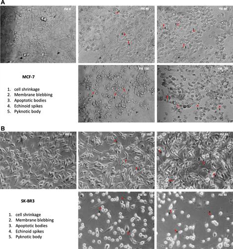 Figure 4 FSE induced morphological changes in breast cancer cells.