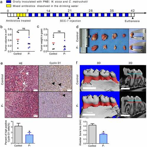 Figure 1. Effects of PNB on tumor growth in SCC-7 tumor-bearing mice. (a) Overview of the experimental protocol of SCC-7 tumor-bearing mice that orally inoculated with PNB. Antibiotic treatments were represented by the yellow squares, and orally inoculated with PNB was represented by the blue squares. (b) Tumor volumes measured at the end of the experiment. (c) Tumor weights detected at the end of the experiment. (d) Gross appearance of tumors. (e) Representative immunohistochemical staining for Cyclin D1 in tumor tissues (high positive cells were indicated by the black arrows). Scale bars, 50 μm. (f) Alveolar bone loss was shown by the red areas in three-digital reconstructions (3D) and the distances between two horizontal lines (blue and red) in sagittal slice views (2D). Scale bars, 1 mm. Control, SCC-7 tumor-bearing mice that orally inoculated with CMC (n = 5); P-, SCC-7 tumor-bearing mice that orally inoculated with PNB (n = 5). Data were represented as means ± SEM. *p < 0.05.