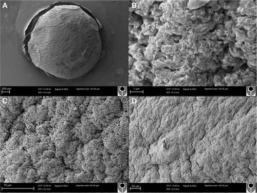 Figure 3 Scanning electron micrographs of gliclazide-deoxycholic acid-sodium alginate microcapsules at various angles.