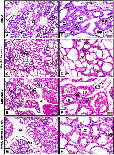 Figure 1 Microscopy of histological sections from breasts of mother rats among the groups. (A and B) MNU; (C and D) A. muricata; (E and F) MNU and BV; (G and H) MNU, A. muricata, and BV.