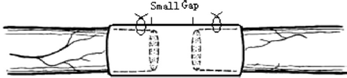 Figure 1. Schematic diagram of small gap sleeve bridging peripheral nerve mutilation.