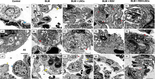 Figure 8. Representative electron photomicrographs of lung tissue in animals euthanized 21 days after BLM challenge. (A1–A3) shows control group type II pneumocyte in A1 that exhibits an euchromatic nucleus (N), organized lamellar bodies (L) and mitochondria (m) in their cytoplasm with normal microvillus border (MV).AS; alveolar space. Cp; capillary. Blue arrowhead; a type I pneumocyte cytoplasm. (A2) High power magnification of a pneumocyte type II shows a nucleus (N) and multiple typically organized lamellar bodies (L) with glycogen (g) accumulation. (A3) A type I pneumocyte (blue arrowhead) shows an euchromatic nucleus (N) and an intact fused basal lamina (yellow arrow). AS; alveolar space. (B1–B3) BLM + vehicle group: (B1) shows disruption of the blood alveolar barrier (black arrow) and splitted basal lamina (yellow arrow). A monocyte (Mo) within the lumen of a capillary (Cp) and irregular extravasated RBCs (R) are seen. E; endothelial cell. AS; alveolar space. (B2) shows a pneumocyte type II (red arrowhead) with vacuolated lamellar bodies (L) with excessive deposition of collagen (C). (B3) A capillary contains multiple monocytes (Mo) and irregular RBCs (R2). Extravasated RBCs (R) within the alveolar space (AS) are seen. Note splitting of the basal lamina (yellow arrow). (C1–C3) BLM + LNCs group (C1) narrow alveolar spaces (AS) containing extruded cells (asterisk). (C2) extensive collagen deposition (C) encroaching upon a pneumocyte type II (red arrowhead) that appears with vacuolated disorganized lamellar bodies (L). sp; septal cell. (C3) A macrophage (M) extending extensive pseudopodia and an extravasated RBC (R) are seen within the alveolar space. A pneumocyte type II (red arrowhead) displaying a shrunken heterochromatic nucleus (N) and fused giant mitochondria(m) is shown. Splitting of the basal lamina (yellow arrow) is noted. (D1–D3) BLM + RSV group: (D1) shows hyperplasia of pneumocytes type II (red arrowheads) and collapsed alveolar spaces (AS). (D2) wide spread collagen deposition(C) impinging on a pneumocyte type II that appears with irregular outlines, a shrunken heterochromatic nucleus (N) and vacuolated lamellar bodies (L). (D3) shows multiple macrophages (M) and an extravasated RBC (R) within the alveolar space (AS). (E1–E3) BLM + RSV-LNCs group: (E1) shows a pneumocyte type II with a shrunken heterochromatic nucleus (N), dilated perinuclear cisternae together with dilated rER cisternae (r), and vacuolated lamellar bodies (L). sp; septal cell. (E2) shows a pneumocyte type II (red arrowhead) with a shrunken irregular heterochromatic nucleus (N) and lamellar bodies (L). Extensive collagen deposition (C) is noted. (E3) A pneumocyte type II (red arrowhead) with a peripheral irregular nucleus (N) and lamellar bodies (L). M; an alveolar macrophage (M).