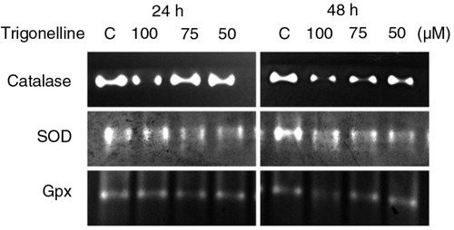 Fig. 6 Effects of trigonelline on superoxide dismutase (SOD), catalase, and glutathione peroxidase (Gpx) activity in Hep3B cells. Cells were treated with vehicle alone or with 50, 75, or 100 µM trigonelline for 24 and 48 h. Native gel analysis was performed to analyze the activity of SOD, catalase and glutathione peroxidase. Proteins were separated by electrophoresis through a 10% native PAGE gel. Activities of SOD, catalase, and glutathione peroxidase were analyzed as described in Materials and Methods section. Results are representative of three independent experiments.