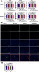 Figure S1 NSE from lymphoma cells did not affect the expression of M1 polarization markers. (A) THP-1 cells were co-cultured with different lymphoma cells for 72 hrs and then the M1 phenotype marker mRNA levels of CD86, IL-12p40, and TNF-α were analyzed using RT-qPCR and statistically analyzed. Data were shown as the mean ± SD (n=3), ns P>0.05. (B1) and (B2) Expression levels of CD68+ CD86+ cells in xenografts tissues were quantified through double immunohistofluorescence. Data were shown as the mean ± SD (n=4). ns P>0.05.