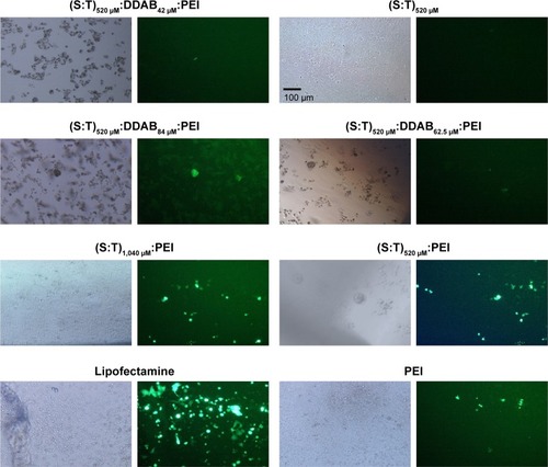 Figure 5 Transfection efficiency in MCF-7 cells with different cationic vesicles.Notes: In all treatments, cells were transfected by polyplexes containing UCA1 shRNA. Fluorescence microscopy images are shown in the right and images of the same cells obtained by light microscopy are shown in the left. In all PEI-containing treatments, the PEI concentrations were the same (1.3 μL PEI; 1 mg/mL) for transfection of 5×105 MCF-7 cells in 300 μL of medium (4.3 μg/mL). Scale bar=100 μm.Abbreviations: DDAB, didodecyldimethylammonium bromide; PEI, polyethyleneimine; S, squalene; T, Tween 80.