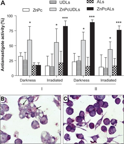 Figure 4 Antiamastigote activity of free or liposomal ZnPc in the darkness and after irradiation.Notes: (A) J774 cells previously infected with Leishmania braziliensis promastigotes were incubated with 0.01 μM (I) and 0.1 μM (II) of ZnPc, ZnPcUDLs, and ZnPcALs, and with void liposomes (UDLs and ALs at the phospholipid concentrations 7.6–5.2 [I] μM and 76–52 [II] μM) for 4 hours in medium containing 5% fetal calf serum. Half the cells were kept in darkness, and half were irradiated. After irradiation, cells were incubated for 24 hours in growth medium. Then cells were fixed with methanol and stained with Giemsa (Merck, New Jersey, USA). The number of amastigotes/100 cells was determined by counting at least 300 cells in three different experiments, and antiamastigote activity was calculated. (B,C) Optical microscopy of infected J774 cells incubated with 0.01 μM ZnPc (B) and 0.01 μM ZnPcALs (C), both taken 24 hours after irradiation. Arrows points to intracellular amastigotes. *P<0.05; ***P<0.001.Abbreviations: ZnPc, zinc phthalocyanine; ZnPcUDLs, ZnPc containing ultradeformable liposomes; ZnPcALs, ZnPc and archaeolipids containing liposomes; UDLs, ultradeformable liposomes; ALs, archaeolipids containing liposomes.