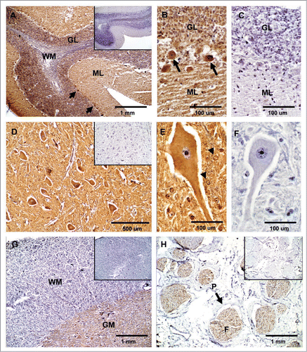 Figure 2 Expression of PrPC in bovine neural tissues. Transverse tissue section incubated with SAF-32 antibody and stained using peroxidase. (A) PrPC staining (brown) is intensely present in Purkinje cells (arrows) and cells of the molecular layer (ML) and granular layer (GL) in the cerebellum. Less immunoreactivity is observed in the white matter (WM). (B) Higher magnification shows intense staining in fibers of the ML, Purkinje cells (arrows) and neurons of the GL. (D) In the solitary tract nucleus of the obex, PrPC is associated to neuronal bodies, neuropil and neuroglia. (E) Higher magnification shows labeling of PrPC in neuronal bodies, appendixes and glial cells (arrow-heads). (G) PrPC immunoreactivity in the spinal cord is confined to the gray matter (GM) with low intensity in the white matter (WM). (H) In the sciatic nerve, PrPC staining is restricted to neural fibers associated in fascicles (F). No PrPC labeling was observed in the perineurium (P). Inserts and figures C (cerebellum) and F (obex) represent serial sections incubated with non-immune horse serum instead of SAF-32 antibody (negative control).
