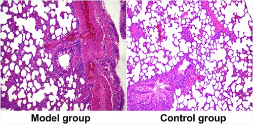 Figure 1. Lung tissue sections of rats in two groups. The HE staining figures show the model group and control group.