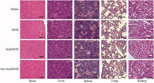 Figure 8. Hematoxylin-eosin (H&E) analyses of heart, liver, spleen, lung, and kidney after treatment with saline, DOX, Se@DOX, and GA-Se@DOX, respectively. Scale bar is 50 μm.