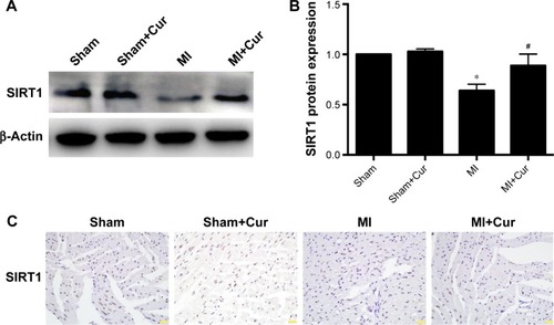 Figure 2 Effects of curcumin on SIRT1 expression after MI in vivo.