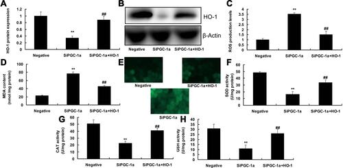 Figure 5 Induction of HO-1 participated in the function of PGC-1α in Diabetes mellitus with myocardial infarction. HO-1 protein expression (A and B), ROS production levels (C and D), MDA SOD, CAT and GSH activity levels (E–H). Negative, negative group; si-PGC-1α, down-regulation of PGC-1α group; si-PGC-1α+HO-1, down-regulation of PGC-1α and over-expression of HO-1 group. **p<0.01 versus negative group, ##p<0.01 versus down-regulation of PGC-1α group.