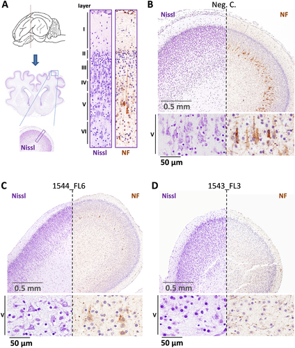 Fig. 6 Neurodepletion in the parietal lobe following IU inoculation of ZIKV.a Overview of the localization of the parietal lobe and its cytoarchitecture in the normal fetal pig brain. The different cortical layers (I–VI) are indicated. b Images of Nissl and neurofilament (NF)-stained parietal lobe cross-sections of a negative control fetus and a higher magnification of the pyramidal neurons of cortical layer V. c A fetus presenting moderate neurodepletion in cortical layer V (1544_FL6) and d a fetus presenting severe neurodepletion in cortical layer V with prominent lobe hypoplasia (1543_FL3)