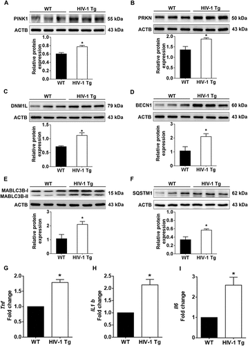 Figure 9. HIV-1 mediated upregulation of mitophagy markers and proinflammatory cytokines in vivo. (a–f) Representative western blots showing the activation of mitophagy markers such as PINK1 (a), PRKN (b), and DNM1L (C) and autophagy markers such as BECN1 (d), MAP1LC3B-II (e), and SQSTM1 (f) in the frontal cortex of wild-type and HIV-1 Tg rats (n = 3). ACTB was probed as a protein loading control for all experiments. (g–i) Representative bar graphs showing the mRNA expression profile of proinflammatory cytokines such as Tnf (g), Il1b (h), and Il6 (I) using qPCR in the frontal cortex of wild-type and HIV-1 Tg rats (n = 3). Gapdh was used as an internal control to normalize the gene expression for all experiments. The data are presented as mean ± SEM from 3 independent experiments. An unpaired Student t test was used to determine the statistical significance. *, P < 0.05 vs. WT