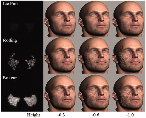 Figure 2. Results of acne scar simulation.