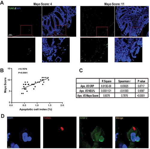 Figure 8. Apoptotic cell accumulation correlates with the Mayo score of ulcerative colitis (UC). (A) Representative images of TUNEL staining of UC patients’ colon biopsies in low and high Mayo Score. (Green: TUNEL staining, blue: DAPI). Scale bar: 100 μm. (B) A scatterplot with a regression line, illustrating the correlation between the apoptotic cell index of the colon and the relevant Mayo Score (33 patients). r, Spearman rank correlation coefficients. (C) Analyzing correlation indexes between apoptotic cell index and inflammatory markers in the peripheric blood system (CPR, C-reactive protein, NEU%, neutrophil %). (D) Representative images of TUNEL-positive debris in NRBF2-positive cells on human UC colon tissue (n = 2 samples). Scale bar: 4 μm. (green, NRBF2, red, TUNEL-positive nuclei)