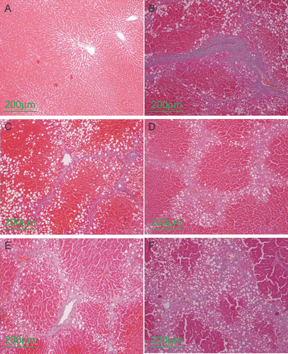 Figure 1.  The representative photographs of Azan-staining (×100). (A) normal group, (B) CCl4 control group, (C) CCl4 and positive control group, (D) CCl4 and high dose baicalin treated group, (E) CCl4 and intermediate dose baicalin treated group, (F) CCl4 and low dose baicalin treated group.