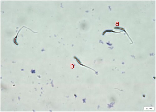 Figure 4. Sperm acrosome morphology after freezing. (400 × Observation under optical microscope), where a is the sperm with intact acrosome and b is the sperm with incomplete acrosome.